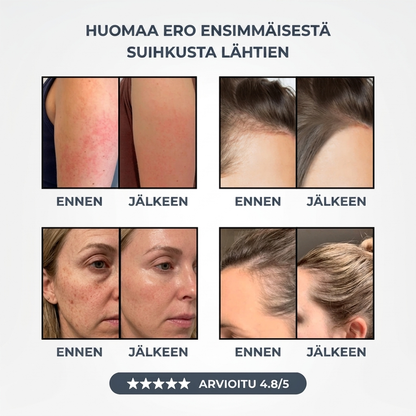 Uudista hiuksesi, ihosi ja suihkusi Casynor